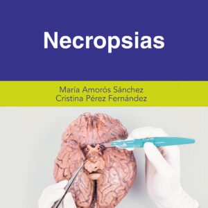 Necropsias