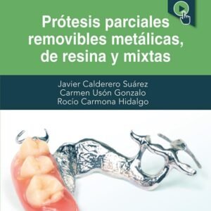 Protesis parciales removibles metalicas de resina y mixtas